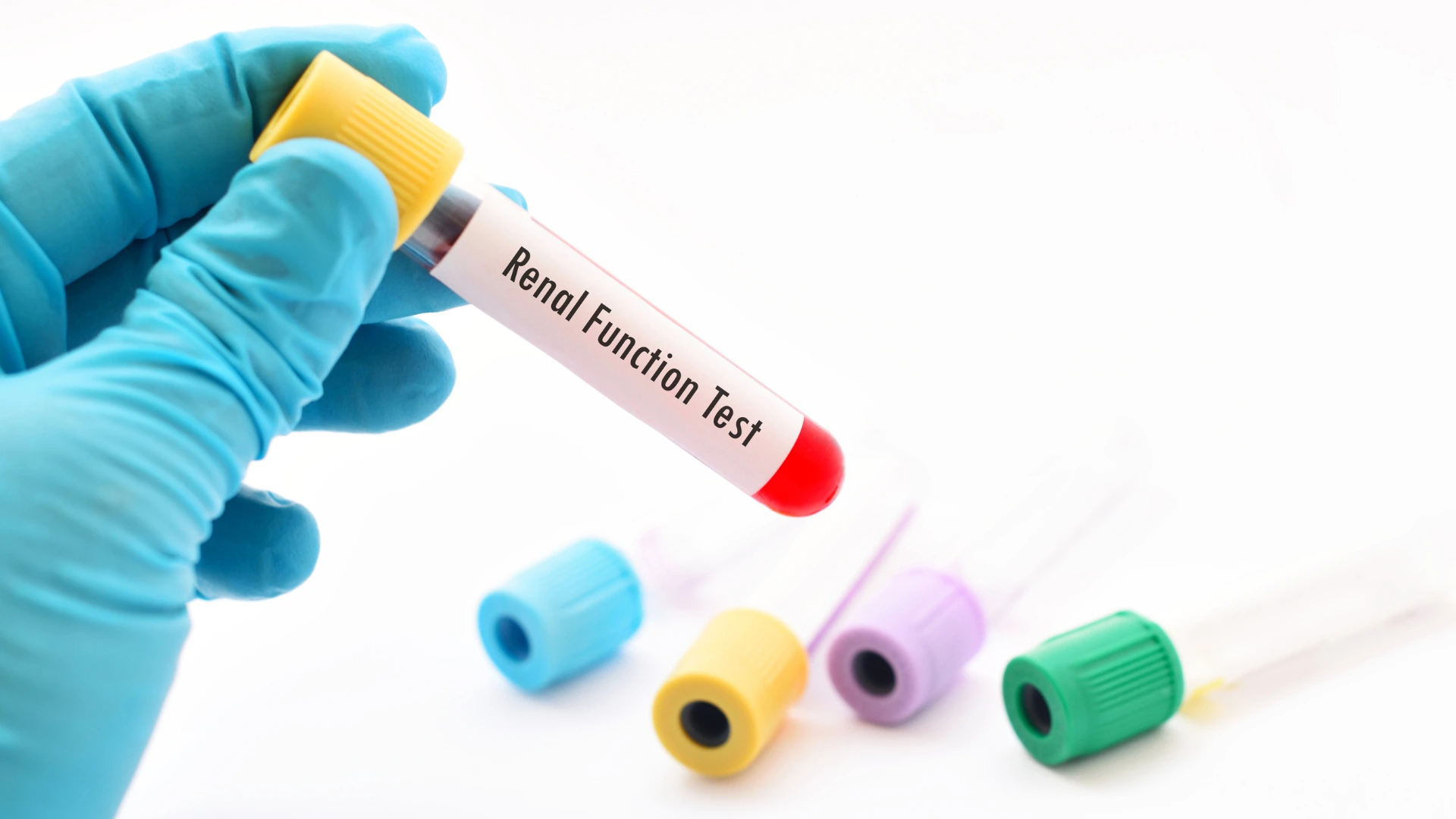 Creatine Phosphokinase